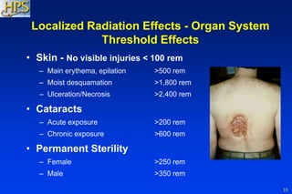 35
• Skin - No visible injuries < 100 rem
– Main erythema, epilation >500 rem
– Moist desquamation >1,800 rem
– Ulceration/Necrosis >2,400 rem
• Cataracts
– Acute exposure >200 rem
– Chronic exposure >600 rem
• Permanent Sterility
– Female >250 rem
– Male >350 rem
Localized Radiation Effects - Organ System
Threshold Effects
 