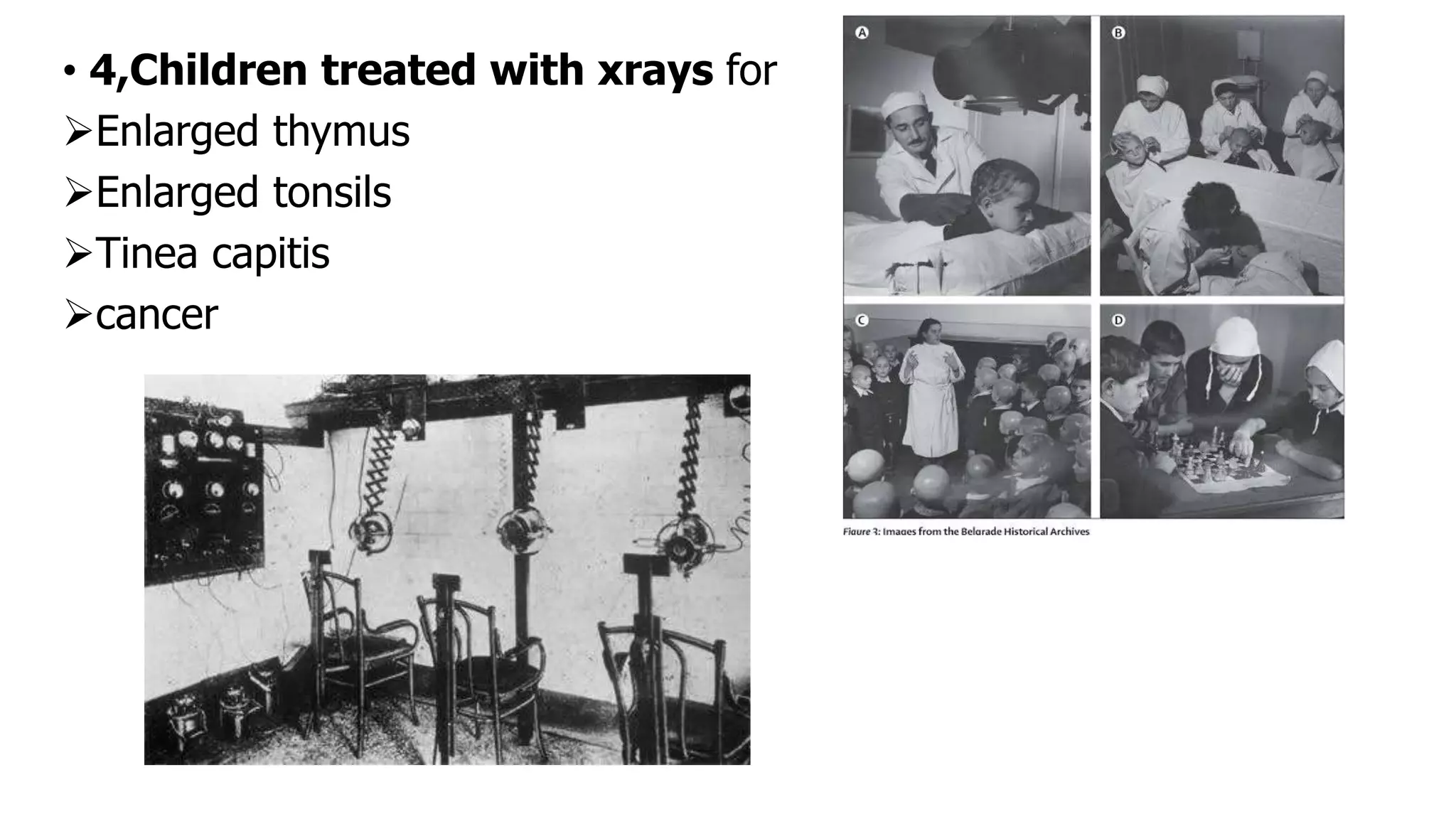 Radiation carcinogenesis