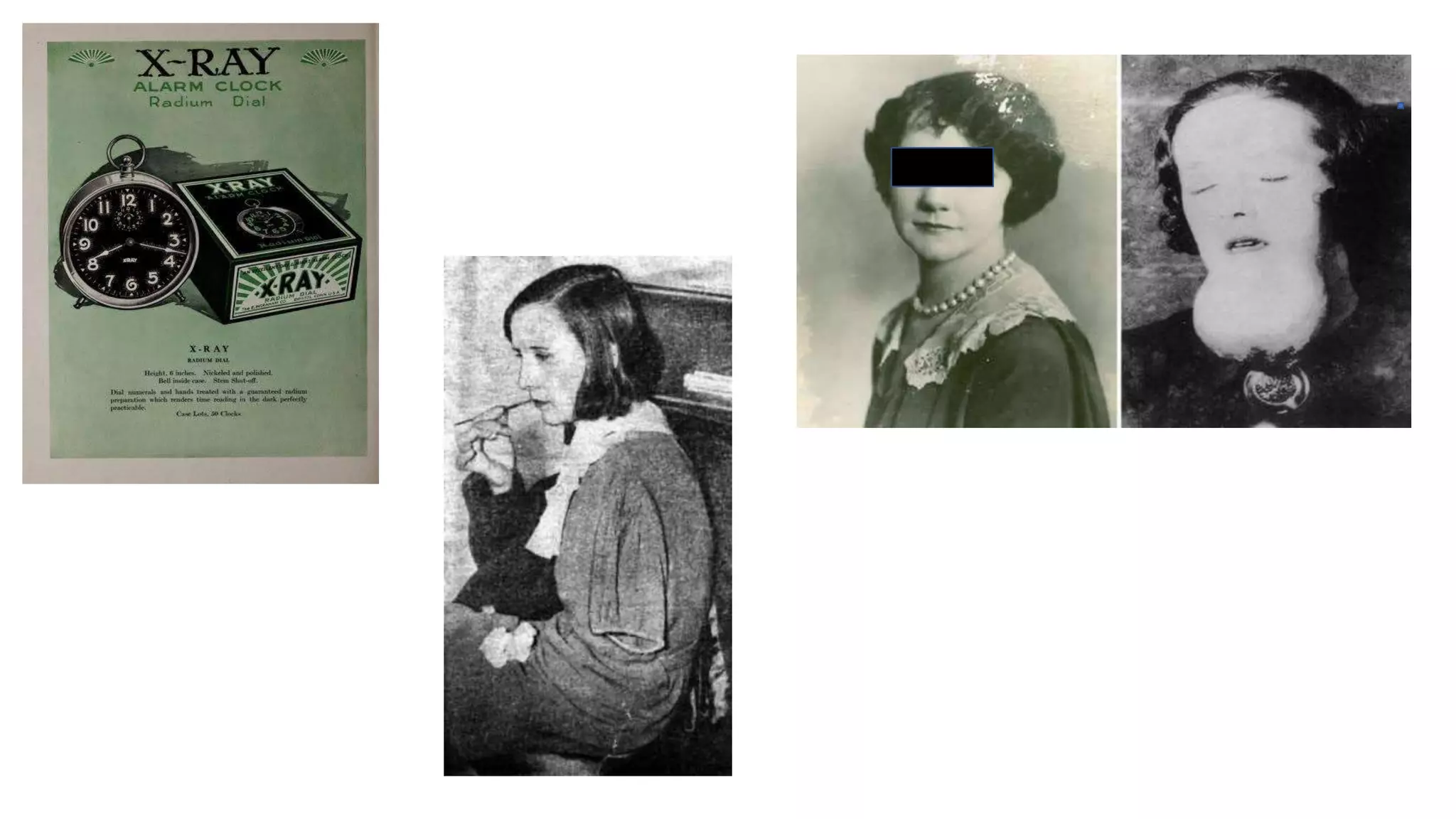 Radiation carcinogenesis