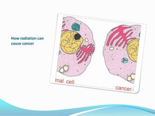 How radiation can cause cancer