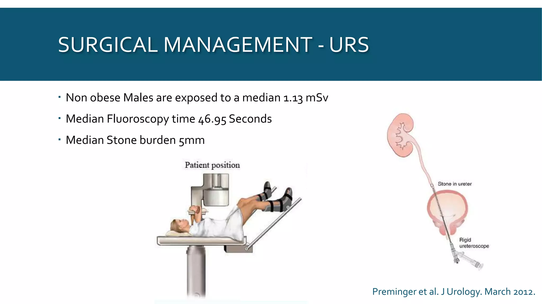 SURGICAL MANAGEMENT - URS
 Non obese Males are exposed to a median 1.13 mSv
 Median Fluoroscopy time 46.95 Seconds
 Median Stone burden 5mm
Preminger et al. J Urology. March 2012.
 