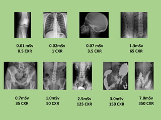 Msv Scale Radiation hazard and radiation protection | PPTX