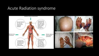 RADIATION HAZARDS ....pptx