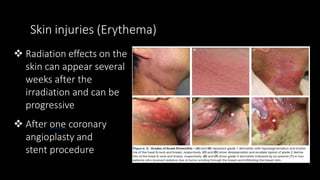 RADIATION HAZARDS ....pptx