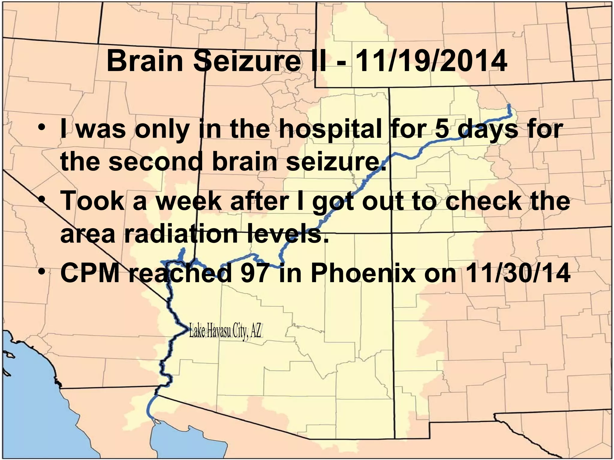 Brain Seizure I From Radiation?
• I had a grand mal seizure 7/19/2014
• Radiation readings from Shell Beach CA, the
next state west of AZ, was at 5 am 90 CPM
http://radiationnetwork.com/Message.htm
 