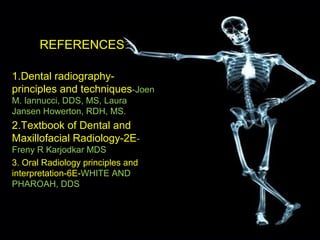 REFERENCES
1.Dental radiography-
principles and techniques-Joen
M. Iannucci, DDS, MS, Laura
Jansen Howerton, RDH, MS.
2.Textbook of Dental and
Maxillofacial Radiology-2E-
Freny R Karjodkar MDS
3. Oral Radiology principles and
interpretation-6E-WHITE AND
PHAROAH, DDS
 