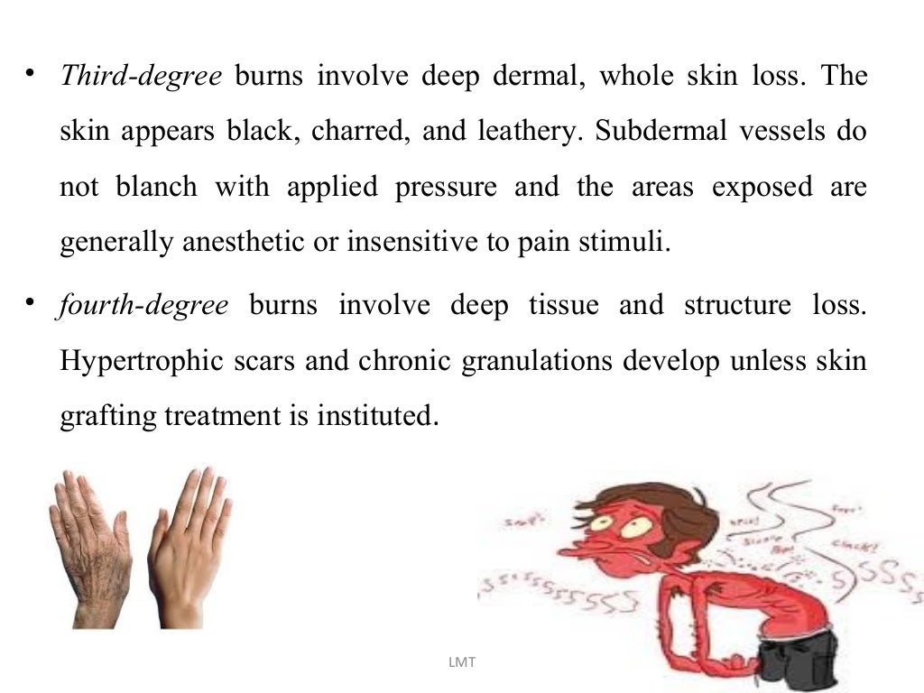 Radiation Poisoning