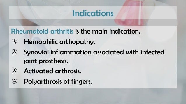 Radiation synovectomy