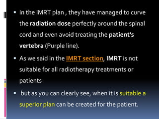  In the IMRT plan , they have managed to curve
the radiation dose perfectly around the spinal
cord and even avoid treating the patient's
vertebra (Purple line).
 As we said in the IMRT section, IMRT is not
suitable for all radiotherapy treatments or
patients
 but as you can clearly see, when it is suitable a
superior plan can be created for the patient.
 