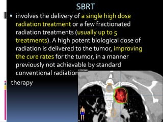 SBRT
 involves the delivery of a single high dose
radiation treatment or a few fractionated
radiation treatments (usually up to 5
treatments). A high potent biological dose of
radiation is delivered to the tumor, improving
the cure rates for the tumor, in a manner
previously not achievable by standard
conventional radiation
therapy
 
