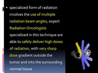  specialized form of radiation
involves the use of multiple
radiation beam angles, expert
Radiation Oncologists
specialized in this technique are
able to safely deliver high doses
of radiation, with very sharp
dose gradient outside the
tumor and into the surrounding
normal tissue
 