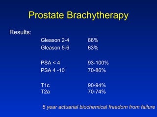 Prostate Brachytherapy
Results:
Gleason 2-4 86%
Gleason 5-6 63%
PSA < 4 93-100%
PSA 4 -10 70-86%
T1c 90-94%
T2a 70-74%
5 year actuarial biochemical freedom from failure
 