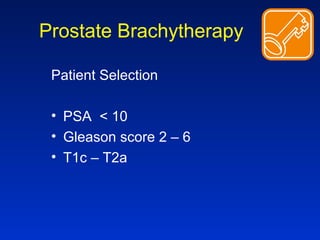 Prostate Brachytherapy
Patient Selection
• PSA < 10
• Gleason score 2 – 6
• T1c – T2a
 