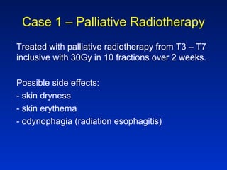 Case 1 – Palliative Radiotherapy
Treated with palliative radiotherapy from T3 – T7
inclusive with 30Gy in 10 fractions over 2 weeks.
Possible side effects:
- skin dryness
- skin erythema
- odynophagia (radiation esophagitis)
 