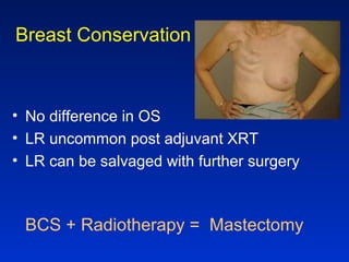 Breast Conservation
• No difference in OS
• LR uncommon post adjuvant XRT
• LR can be salvaged with further surgery
BCS + Radiotherapy = Mastectomy
 