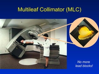 Multileaf Collimator (MLC)
No more
lead blocks!
 
