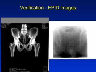 Verification - EPID images
 
