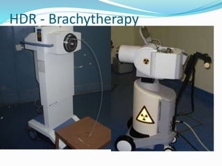 Radiation therapy in Cancer Oesophagus | PPTX