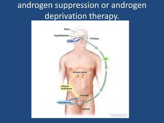 androgen suppression or androgen 
deprivation therapy. 
 