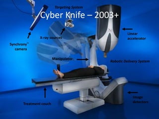 Synchrony™ 
camera 
Cyber Knife – 2003+ 
Treatment couch 
Linear 
accelerator 
Targeting System 
Manipulator 
Image 
detectors 
X-ray sources 
Robotic Delivery System 
 