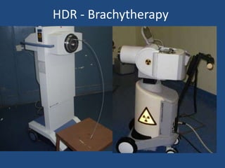 HDR - Brachytherapy 
 