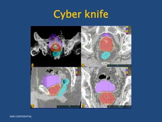AMS CONFIDENTIAL 
Cyber knife 
 