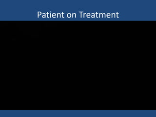 Patient on Treatment 
 