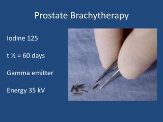 Prostate Brachytherapy 
Iodine 125 
t ½ = 60 days 
Gamma emitter 
Energy 35 kV 
 