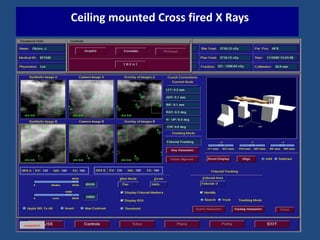 Ceiling mounted Cross fired X Rays 
 