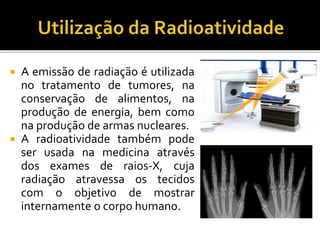  A emissão de radiação é utilizada
no tratamento de tumores, na
conservação de alimentos, na
produção de energia, bem como
na produção de armas nucleares.
 A radioatividade também pode
ser usada na medicina através
dos exames de raios-X, cuja
radiação atravessa os tecidos
com o objetivo de mostrar
internamente o corpo humano.
 