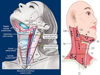 Neck Dissection Rcpa Comprehensive Overview of Radical Neck Dissection Surgery: Indications ...