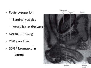 • Postero-superior
– Seminal vesicles
– Ampullae of the vasa
• Normal – 18-20g
• 70% glandular
• 30% Fibromuscular
stroma
 
