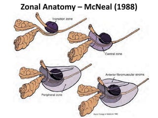 Zonal Anatomy – McNeal (1988)
 