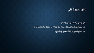 نمای رادیوگرافی 
در اپکس یک دندان نان وایتال • 
در سطح مزیال یا دیستال ریشه یک دندان در مدخل یک کانال فرعی • 
در یک پاکت پریودنتال عمیق )ناشایع( • 
 