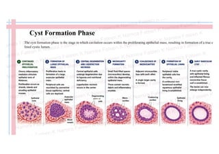 Radicular Cyst – Pathogenesis, Histopathology, Diagnosis & Management | PDF
