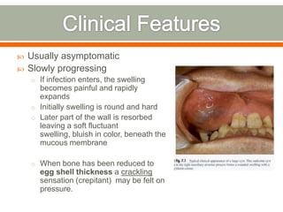  Usually asymptomatic
 Slowly progressing
o If infection enters, the swelling
becomes painful and rapidly
expands
o Initially swelling is round and hard
o Later part of the wall is resorbed
leaving a soft fluctuant
swelling, bluish in color, beneath the
mucous membrane
o When bone has been reduced to
egg shell thickness a crackling
sensation (crepitant) may be felt on
pressure.
 