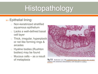  Epithelial lining:
o Non-keratinized stratified
squamous epithelium
o Lacks a well-defined basal
cell layer
o Thick, irregular, hyperplastic
or net like forming rings &
arcades
o Hyaline bodies (Rushton
bodies) may be found
o Mucous cells – as a result
of metaplasia
 