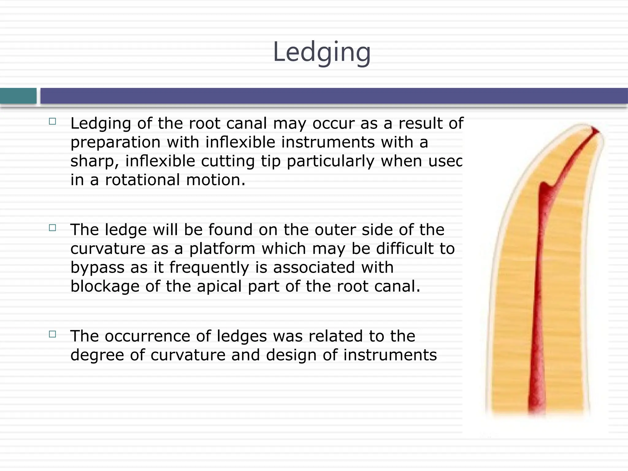  Ledging of the root canal may occur as a result of
preparation with inﬂexible instruments with a
sharp, inﬂexible cutting tip particularly when used
in a rotational motion.
 The ledge will be found on the outer side of the
curvature as a platform which may be difficult to
bypass as it frequently is associated with
blockage of the apical part of the root canal.
 The occurrence of ledges was related to the
degree of curvature and design of instruments
Ledging
 
