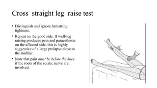 radiculopathy.pptx saroj chandra spine fellow | PPTX