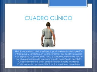 CUADRO CLÍNICO




El dolor aumenta con los esfuerzos, por incremento de la presión
intraespinal y también con los movimientos del cuello; se asocia
con espasmo muscular en la nuca y puede aumentar de noche
 por el alargamiento de la columna en la posición de decúbito;
    Ocasionalmente el dolor puede irradiarse hasta los dedos.
   Posteriormente aparece déficit motor, sensitivo y de reflejos.
 