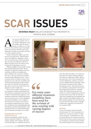 knoWledge case studY                           21




scar issues                    dr patrick treacy evaluates Radiesse™ as a tReatment in
                                               atRophic acne scaRRing




A
                 cne occurs in about 95% of 16-17
                 year-old boys and 84% of 16-17
                 year-old girls. Although the condi-
                 tion usually resolves by the mid
                 twenties; nevertheless, 1% of men
and 5% of women still bear signs of moderately
severe acne scarring at 40 years of age. Some
studies show scarring of some degree may affect
up to 95% of patients with acne.
    Atrophic scarring often appears years later
and can cause great distress. Affected patients
report social inhibition, unhappiness, anxiety,
and even suicide because of their facial appear-
ance. For many years different treatment m