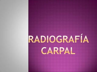 Radiografía Carpal 