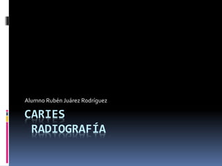 CARIES
RADIOGRAFÍA
Alumno Rubén Juárez Rodríguez
 