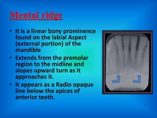 mandibular landmarks of radiograph | PPTX