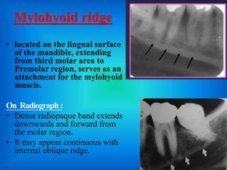 Oblique Ridge Radiography mandibular landmarks of radiograph | PPTX