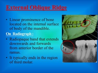 mandibular landmarks of radiograph | PPTX