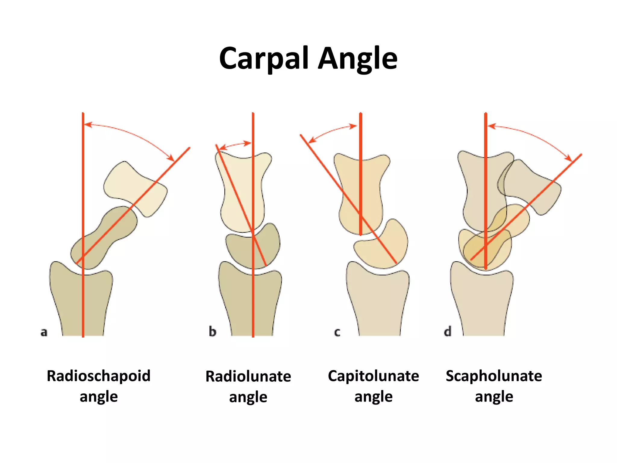 Radio-anatomy and Radio-pathology of hand and wrist.pdf