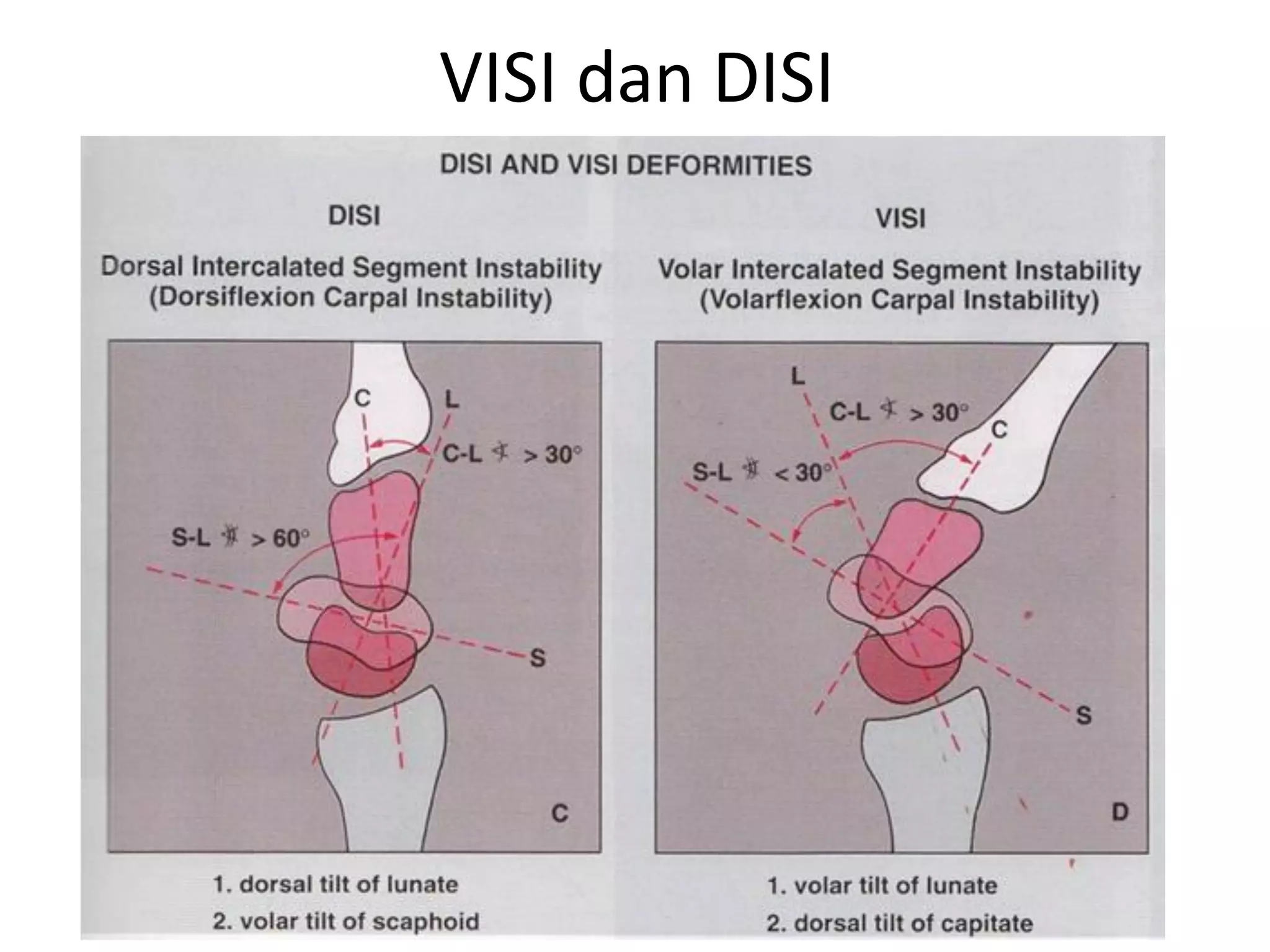 Radio-anatomy and Radio-pathology of hand and wrist.pdf