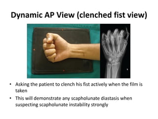 Radio-anatomy and Radio-pathology of hand and wrist.pdf
