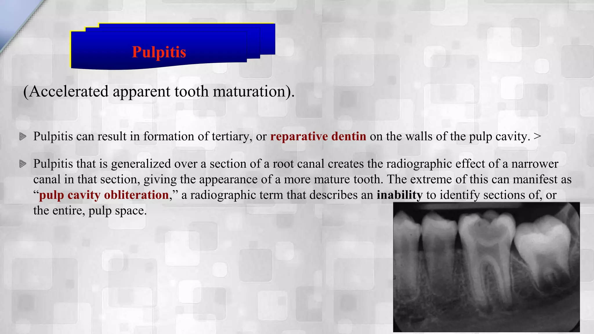 Radiographic findings of Endodontic lesions | PPSX